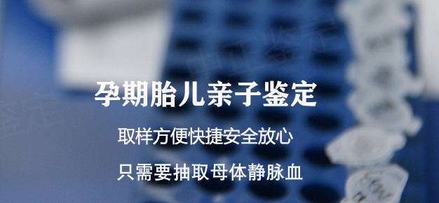 怀孕期间曲靖怎么做胎儿亲子鉴定,曲靖办理怀孕亲子鉴定结果到底准不准确 怀孕期间曲靖怎么做胎儿亲子鉴定,曲靖办理怀孕亲子鉴定结果到底准不准确
