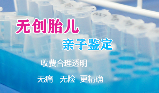 曲靖怀孕几个月如何鉴定孩子生父是谁,曲靖怀孕亲子鉴定如何收费 曲靖怀孕几个月如何鉴定孩子生父是谁,曲靖怀孕亲子鉴定如何收费